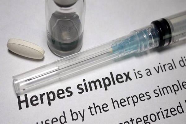 latest herpes research